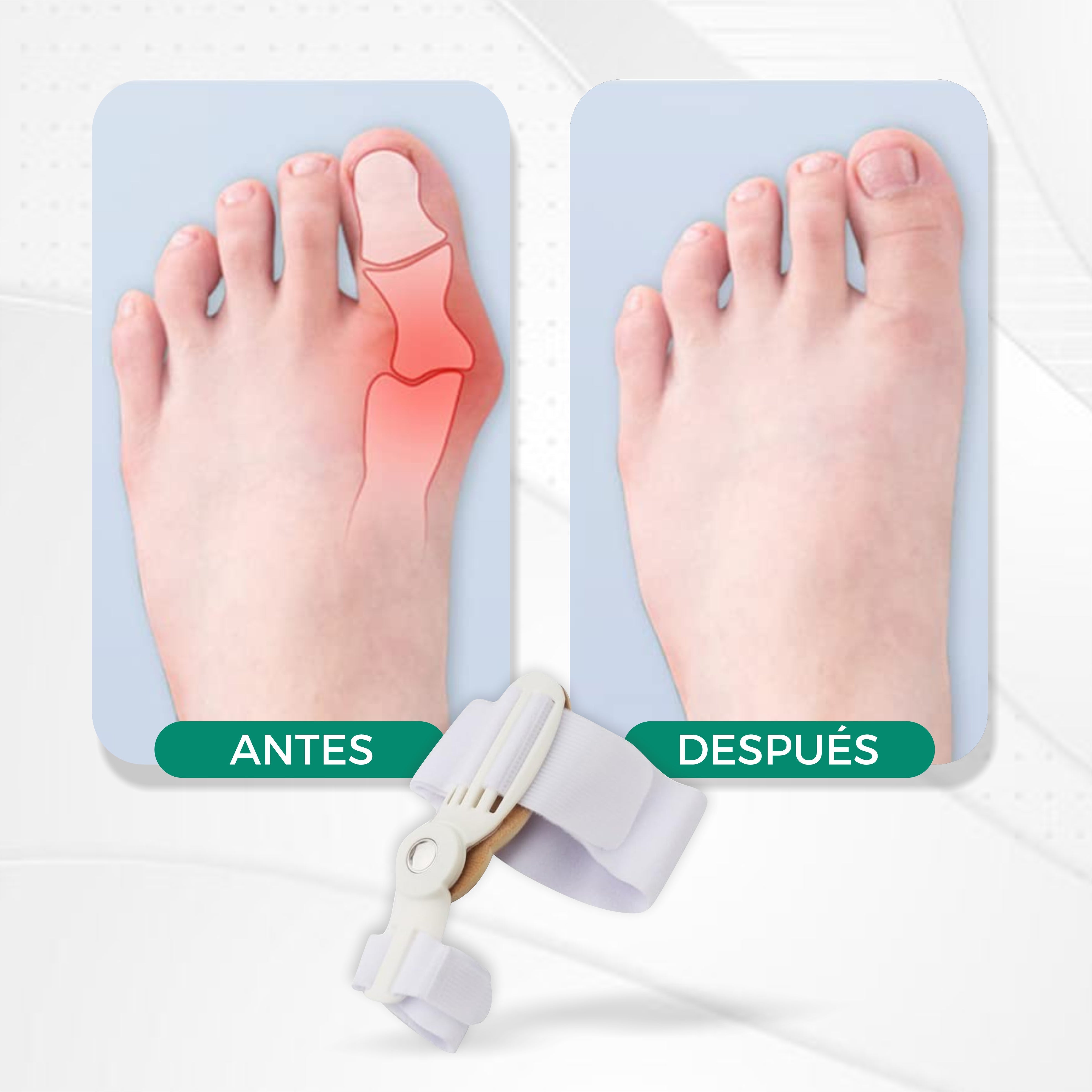 Corrector Profesional De Juanetes  - Podofix©